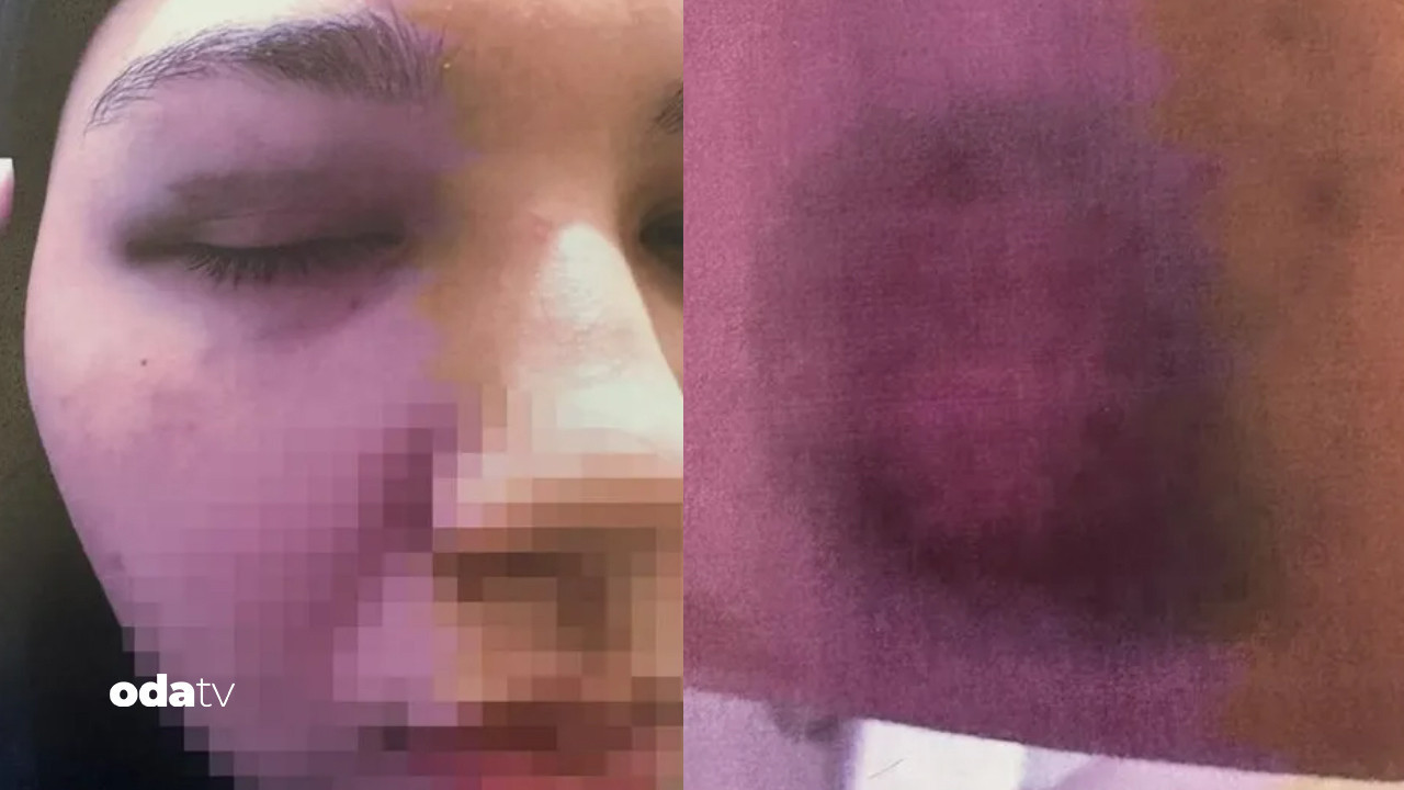 beyoglunda anne kiza bitmeyen siddet hem cinsel hem fiziki dP1ttRxt