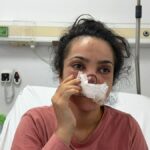 Manisada yamyamlik dehseti burnu koparilan kadin o anlari anlatti sOa6ZZxf