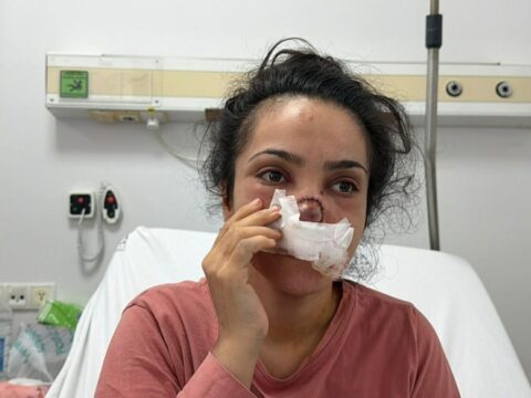 Manisada yamyamlik dehseti burnu koparilan kadin o anlari anlatti sOa6ZZxf