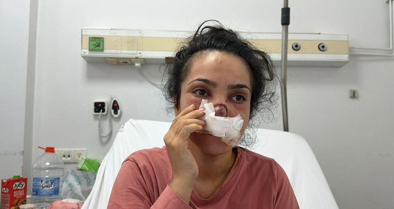 Manisada yamyamlik dehseti burnu koparilan kadin o anlari anlatti sOa6ZZxf